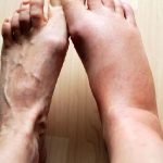 omega-3 for inflammation dha epa