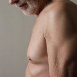 diet exercise omega-3s for sarcopenia