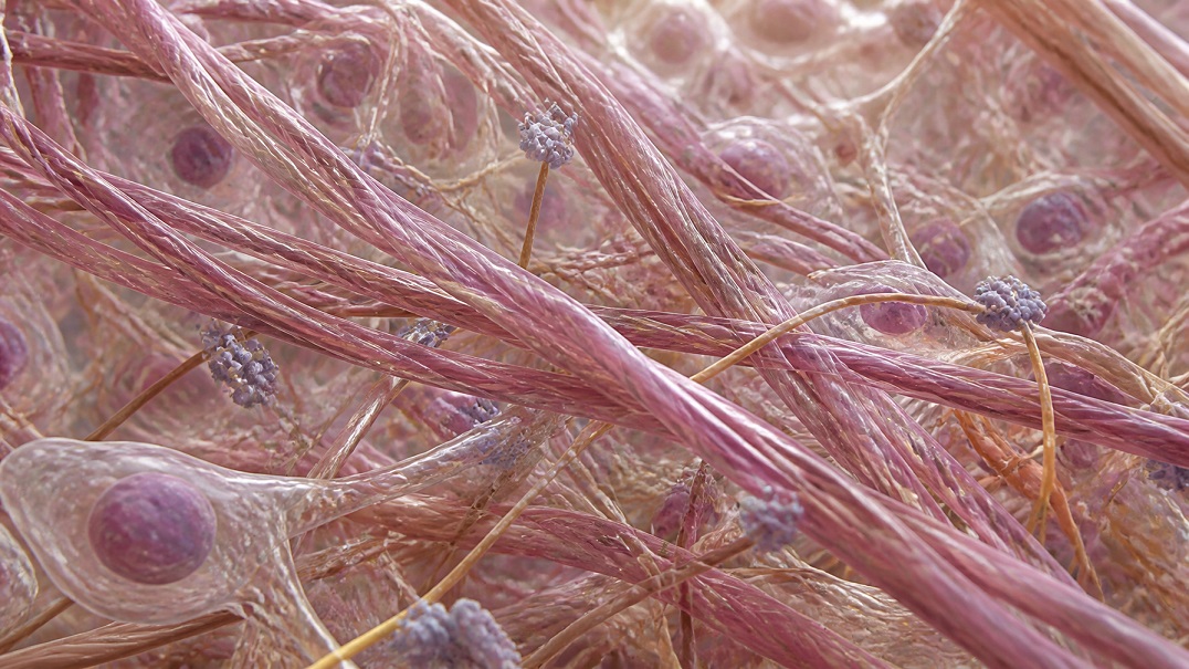 fibromyalgia chronic pain omega-3